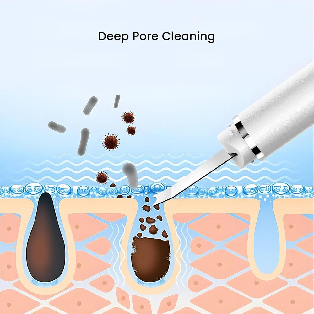 Ultrasonic Skin Scrubber Deep Cleaning Facial Skin Care Face Lifting Machine Ultrasonic Cleaner